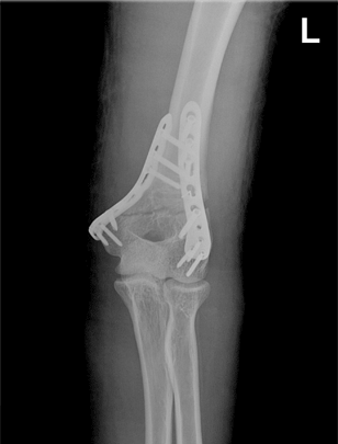 x-ray 사진