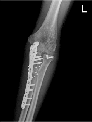x-ray 사진