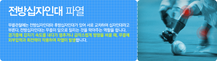 전방십자인대 파열