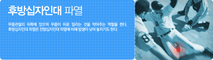 후방십자인대 파열