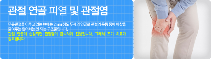 관절 연골 파열 및 관절염