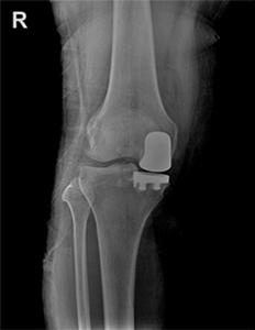x-ray 사진