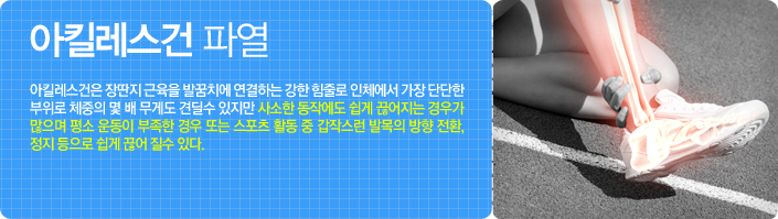 아킬레스건파열