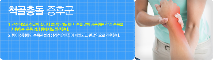 척골충돌 증후군