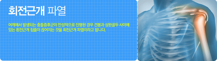 회전건개 파열