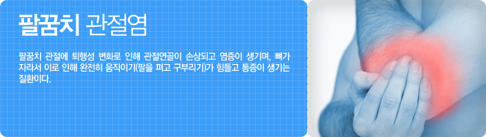 팔꿈치 관절염